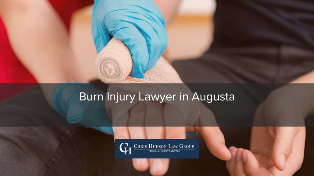 Burn on sale injury lawyer